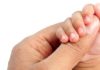 Kids' Skin Conditions